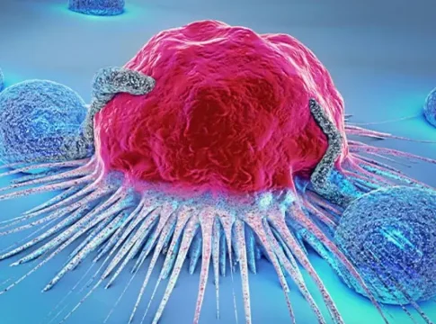 Новая надежда для пациентов с раком мочевого пузыря: экспериментальное лечение показало впечатляющие результаты