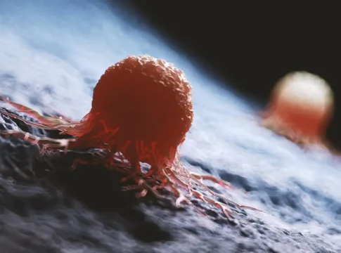 Революционное лечение: новый препарат уничтожил рак мочевого пузыря у 82% пациентов