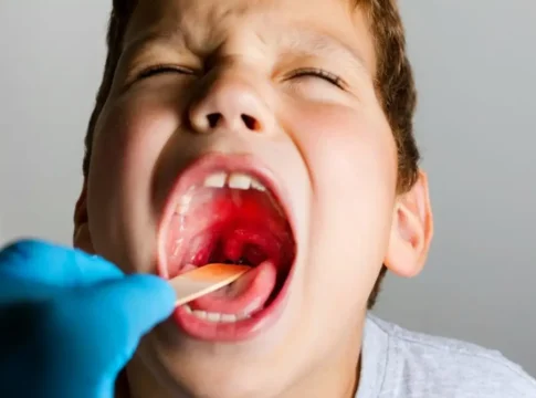 Израиль столкнулся с резким ростом числа случаев заражения «плотоядным» стрептококком