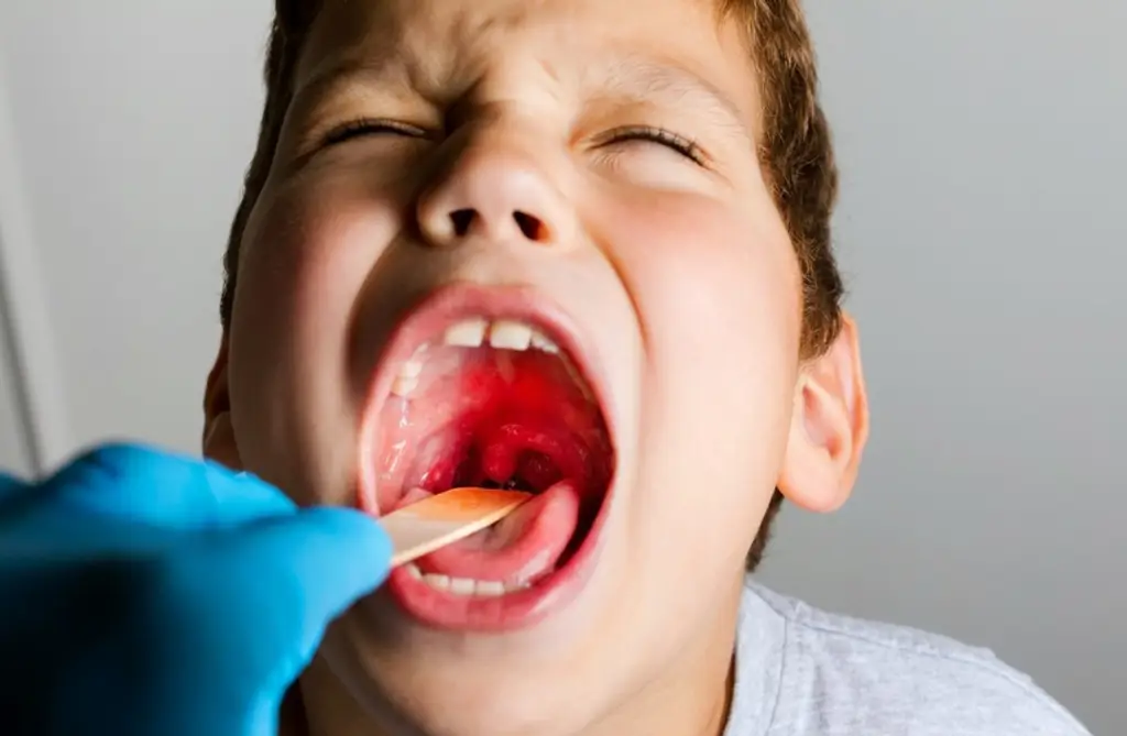 Израиль столкнулся с резким ростом числа случаев заражения «плотоядным» стрептококком