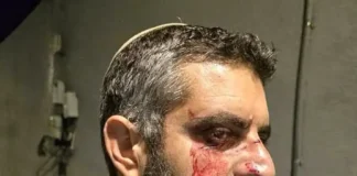 Линч еврейского студента в Яффо: «Виновен в том, что носит кипу»