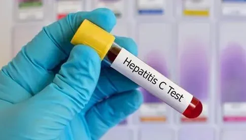 Израильские ученые создали ослабленный вирус гепатита С